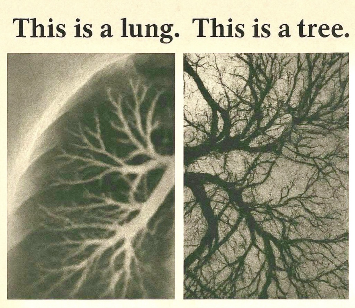 Print comparison: This is a lung. This is a tree.